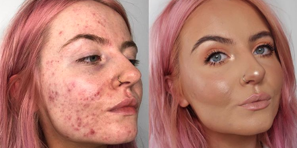 Top 10 Most Catfished Photos For The Month of June