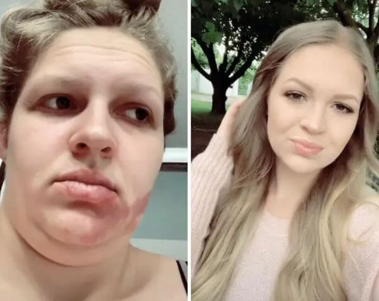 Top 10 Catfish Photos of The Week